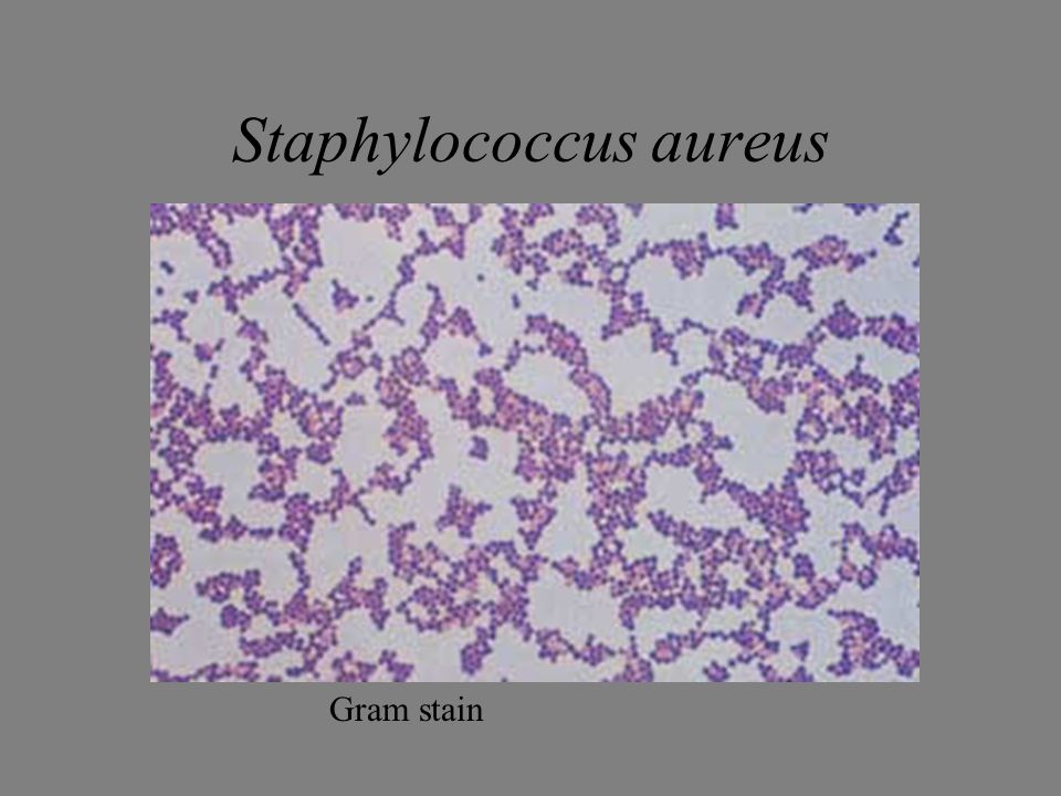 Gram staining staphylococcus aureus and pseudomonas